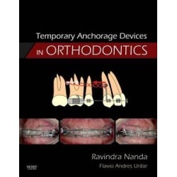 Temporary Anchorage Devices in Orthodontics
