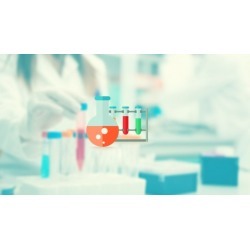 Single Phase Mass Balance