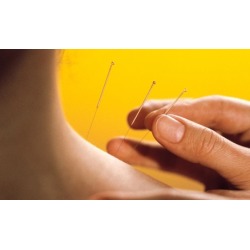 $106 for $205 Worth of Acupuncture - Natural Harmony Acupuncture & Chinese Medicine