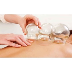 Consultation, Exam, and Cupping or Acupuncture