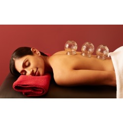 One or Two Cupping Sessions at Optimal Health Acupuncture (Up to 67% Off)