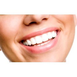 Three Zoom! Teeth-Whitening Sessions, Dental Checkup, or Whitening Kit at SB Dental Studio (Up to 72% Off)