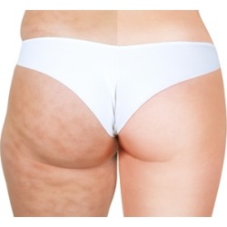 Three, Five, or Nine Non-Invasive Cavitation Treatments at Fit and Beauty Bar (Up to 54% Off)
