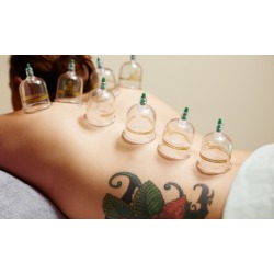 One or Two Acupuncture Sessions and Cupping Massages at Personal Medicine (Up to 81% Off)