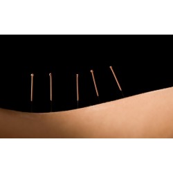 An Acupuncture Treatment and an Initial Consultation at South Denver Acupuncture And Herbal Medicine Clinic (70% Off)