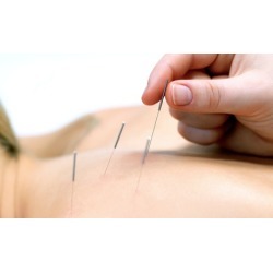 Two Acupuncture Treatments at Complementary Health Care (Up to 76% Off)