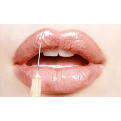 20 or 40 Units of Botox, or One CC of Juvederm at VIP Laser (Up to 52% Off)