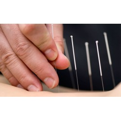 $31.50 for One Acupuncture Treatment for Pain-Management at First Oriental Therapy Center ($125 Value)