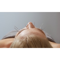 Up to Acupuncture with Massage or Herbal Treatment at Evidence Based Oriental Medicine (Up to 64% Off)