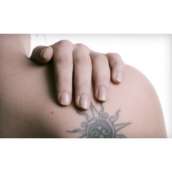 One, Three, or Six Laser Tattoo-Removal Sessions at Laser and Spa Techniques in Rockville Centre (Up to 67% Off)