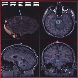 Press
