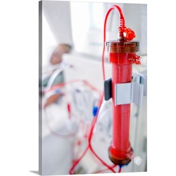 Large Solid-Faced Canvas Print Wall Art Print 20 x 30 entitled Kidney dialysis
