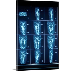 Large Solid-Faced Canvas Print Wall Art Print 20 x 30 entitled Cardiovascular scan