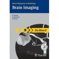 dx direct set brain imaging direct diagnosis in radiology